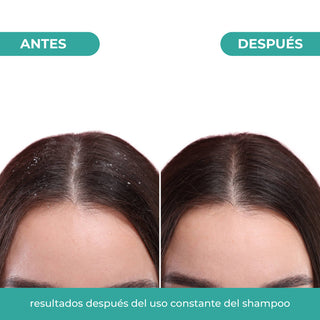 Champú Control Caspa 300ml