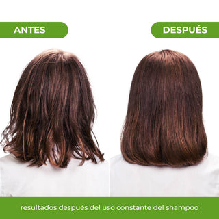 Champú Control Graso 300 ml